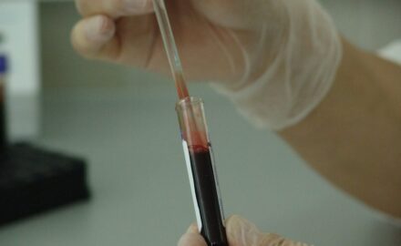 A medical professional tests a blood sample