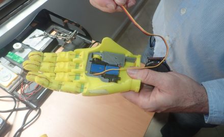 Humanos 3D Foundation Literally “Giving A Hand” To Deserving Young Colombians In Need Of Advanced Prosthetics