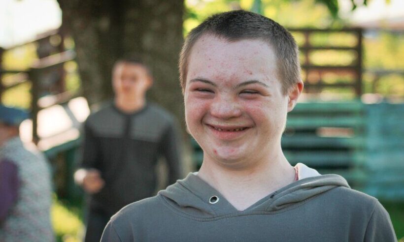Down syndrome